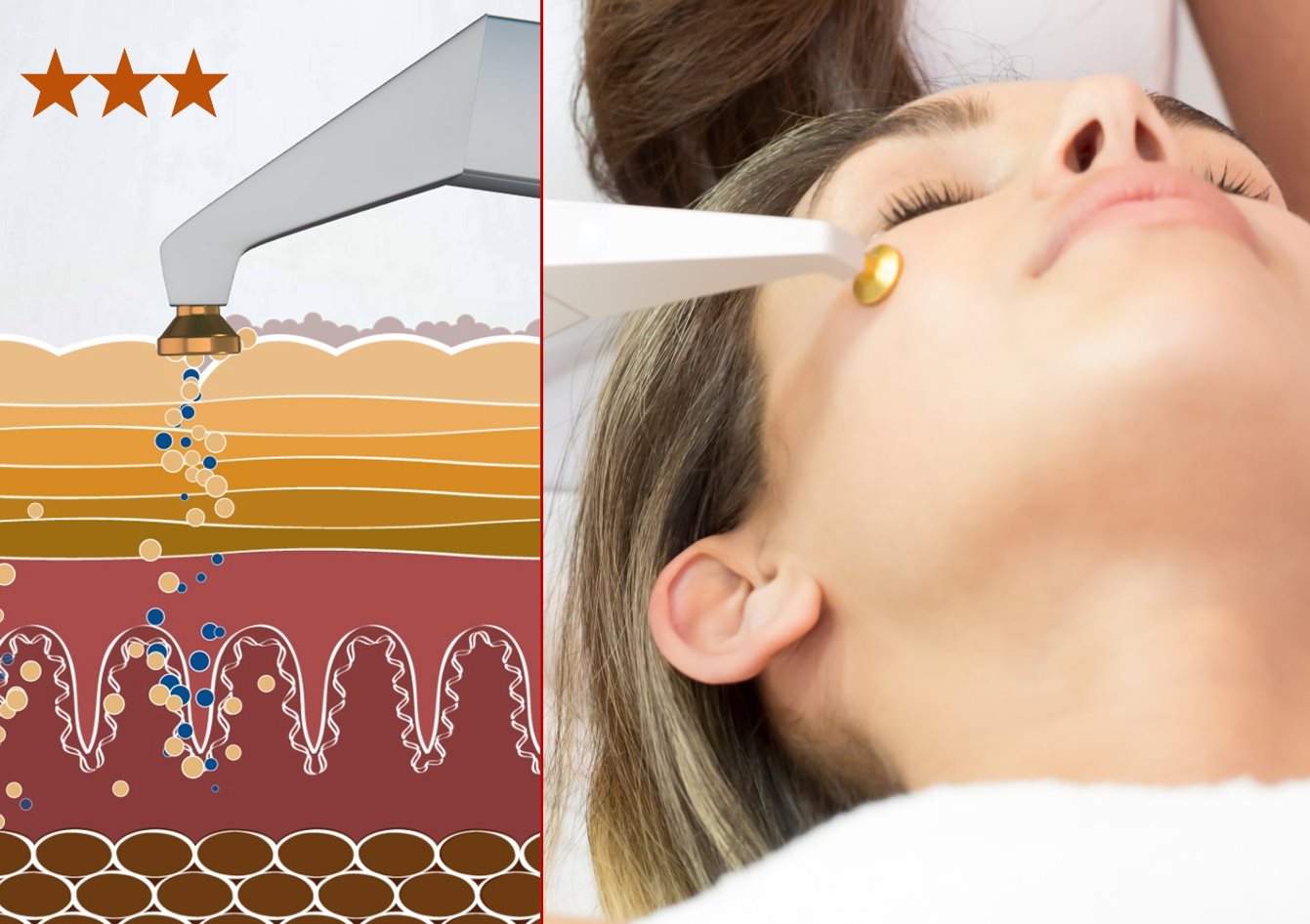 Zuuurstofbehandeling_nora_bode_sunfit_beauty_care_amsterdam