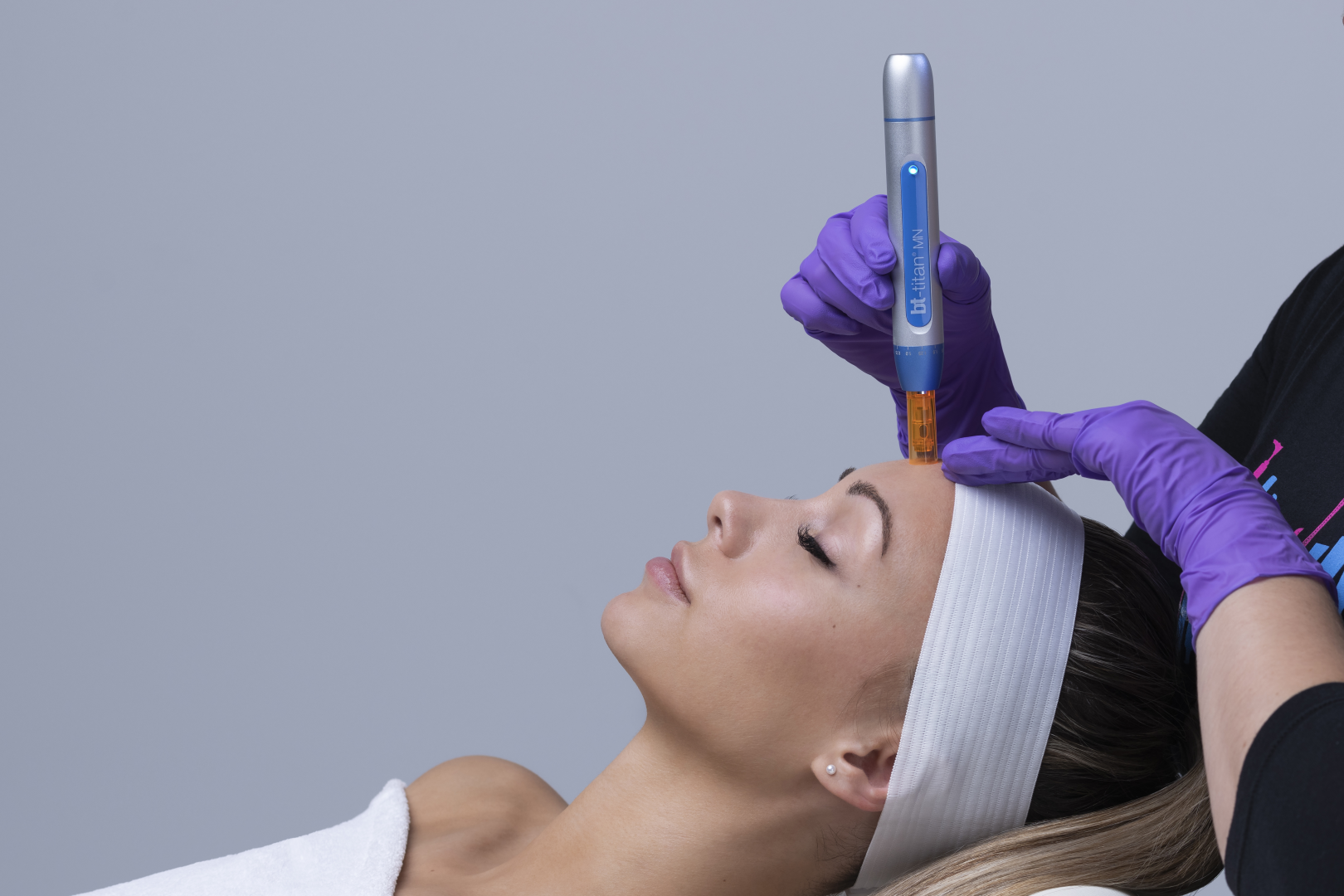microneedling_voor_een_jeugdige_huid_amsterdam_sunfit_beauty_care_01