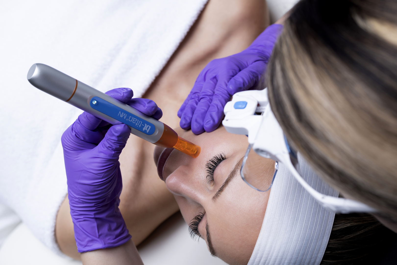 microneedling_voor_een_jeugdige_huid_amsterdam_sunfit_beauty_care_02